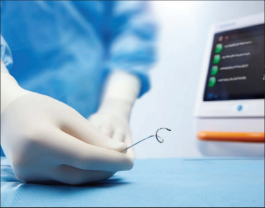  RDN | 經(jīng)腎動(dòng)脈去交感神經(jīng)術(shù)——高血壓微創(chuàng)介入治療